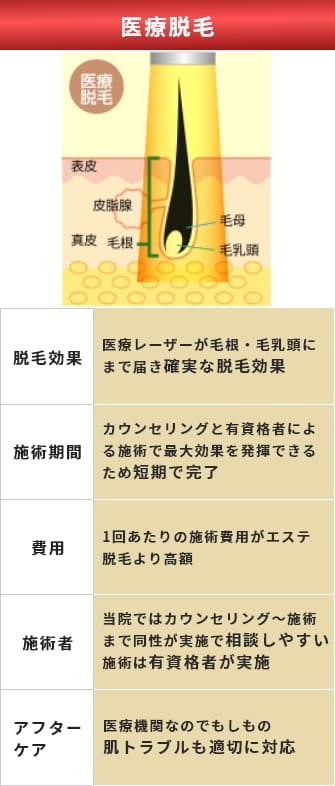 医療脱毛 脱毛効果 医療レーザーが毛根・毛乳頭にまで届き確実な脱毛効果 施術期間 カウンセリングと有資格者による施術で最大効果を発揮できるため短期で完了 費用 1回あたりの施術費用がエステ脱毛より高額 施術者 当院ではカウンセリング～施術まで同性が実施で相談しやすい施術は有資格者が実施 アフターケア 医療機関なのでもしもの肌トラブルも適切に対応