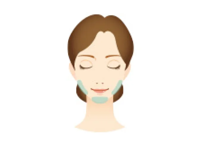 脂肪溶解注射（頬・あご）