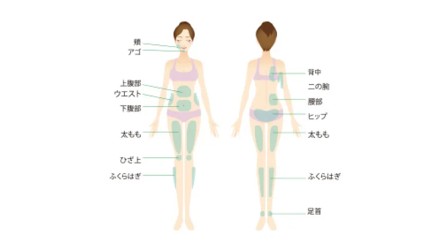 ダイエット注射（メソセラピー）