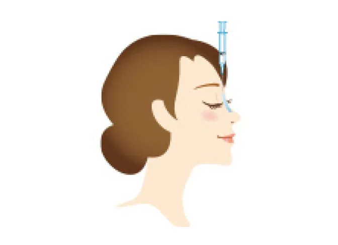 切らない隆鼻術（隆鼻注射法）